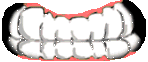mouth1
